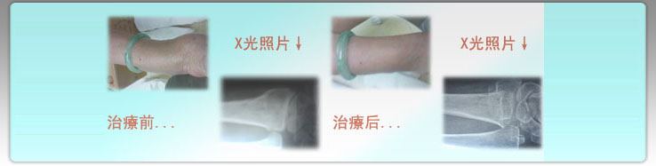 黃錦華跌打骨科 Banner